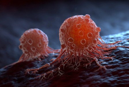 Researchers may have figured out how cancer spreads